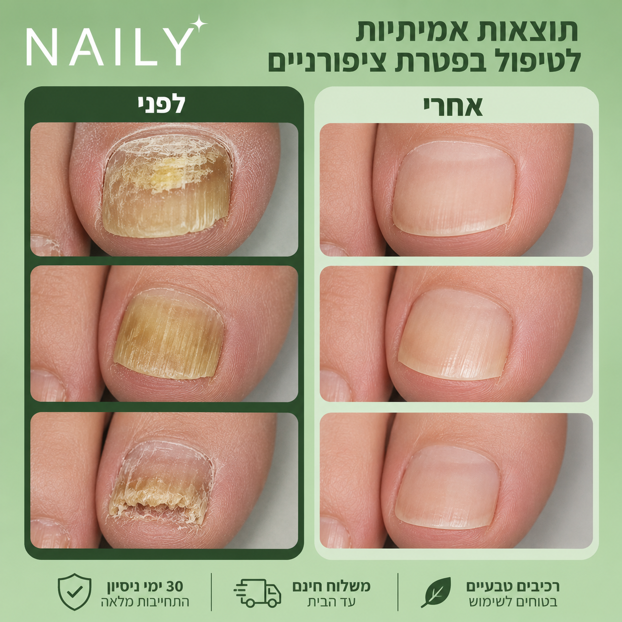 סרום לטיפול בפטרת ציפורניים
