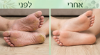 Naily - מארז לטיפול פטרת ציפוניים